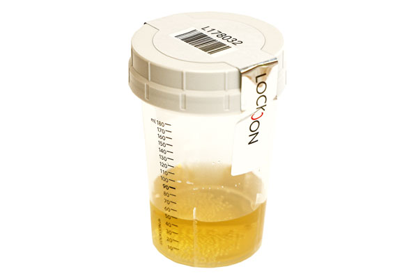 Partial Sample with Urine collection vessel